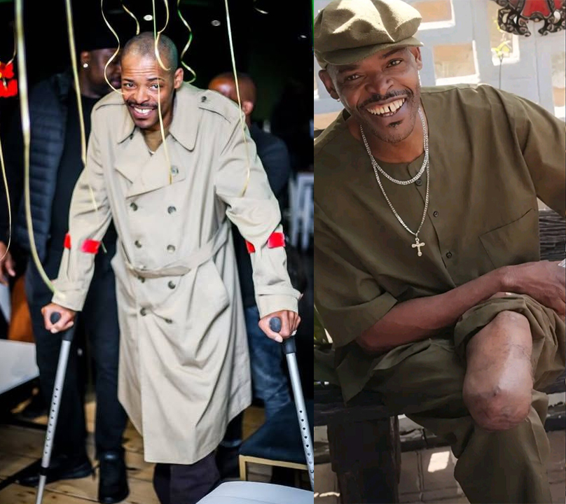 Veteran actor Israel Matseke-Zulu is reportedly recovering after undergoing anot…